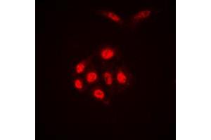 Immunofluorescent analysis of Histone H4 (AcK16) staining in HEK293T cells.