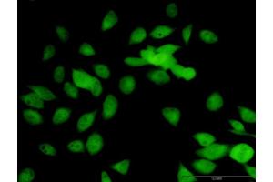 Immunofluorescence of purified MaxPab antibody to LOXL1 on HeLa cell. (LOXL1 antibody  (AA 1-574))