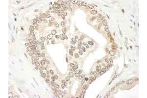 Immunohistochemistry (IHC) image for anti-Janus Kinase 2 (JAK2) (AA 1082-1132) antibody (ABIN7454809) (JAK2 antibody  (AA 1082-1132))