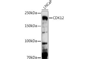 Western blot analysis of extracts of LNCaP cells, using CDK12 antibody (ABIN7266230) at 1:1000 dilution.