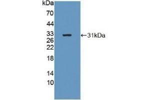 Detection of Recombinant b4GALNT2, Human using Polyclonal Antibody to Beta-1,4-N-Acetyl Galactosaminyl Transferase 2 (b4GALNT2) (B4GALNT2 antibody  (AA 324-566))