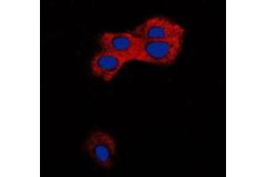 Immunofluorescent analysis of TGF beta 1 staining in MCF7 cells.
