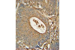 Paraformaldehyde-fixed, paraffin embedded human colon tissue, Antigen retrieval by boiling in sodium citrate buffer (pH6. (ACOX1 antibody)