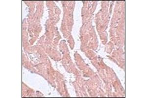Immunohistochemistry of LZTR1 in mouse heart tissue with this product at 5 μg/ml. (LZTR1 antibody  (N-Term))