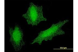 Immunofluorescence of monoclonal antibody to VHL on HeLa cell. (VHL antibody  (AA 1-110))
