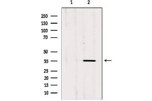 Western blot analysis of extracts from rat brain, using OR3A1 Antibody. (OR3A1 antibody)