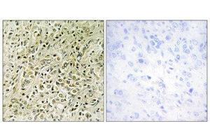 Immunohistochemistry (IHC) image for anti-Deleted in Liver Cancer 1 (DLC1) (N-Term) antibody (ABIN1849916) (DLC1 antibody  (N-Term))
