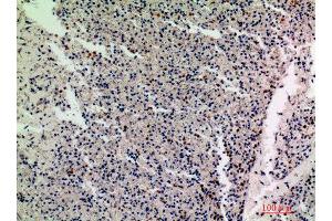 Immunohistochemistry (IHC) analysis of paraffin-embedded Human Spleen, antibody was diluted at 1:200. (IL1F10 antibody)