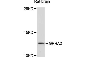 Western blot analysis of extracts of rat brain, using GPHA2 antibody (ABIN4903807) at 1:1000 dilution. (GPHa2 antibody)