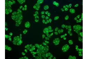 Image no. 5 for anti-Crystallin, alpha B (CRYAB) antibody (ABIN1497644) (CRYAB antibody)