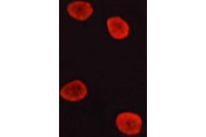 ABIN6266535 staining lovo cells by ICC/IF. (ERK1/2 antibody)