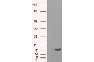 Image no. 8 for anti-Crystallin, alpha B (CRYAB) antibody (ABIN1497645) (CRYAB antibody)