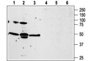 Western blot analysis of human prostate carcinoma PC3 (lanes 1 and 4), and LNCaP (lanes 2 and 5), and human T cell leukemia Jurkat (lanes 3 and 6) cell lines: - 1-3.