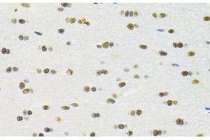 Immunohistochemistry of paraffin-embedded Rat brain using RBPJ Polyclonal Antibody at dilution of 1:100 (40x lens). (RBPJ antibody)