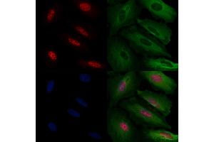 ABIN6263185 and ABIN6272471 staining  cells by IF/ICC.