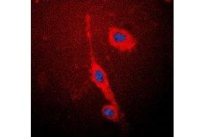 Immunofluorescent analysis of eNOS staining in MCF7 cells. (ENOS antibody  (C-Term))