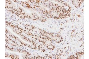 IHC-P Image Immunohistochemical analysis of paraffin-embedded PC14 xenograft, using MKRN1, antibody at 1:100 dilution. (MKRN1 antibody)