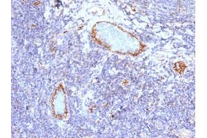 Formalin-fixed, paraffin-embedded human Tonsil stained with vWF Mouse Monoclonal Antibody (VWF/1465). (VWF antibody  (AA 1815-1939))