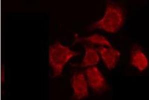 ABIN6274901 staining HepG2 by IF/ICC. (BCL2L12 antibody  (Internal Region))