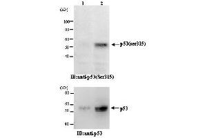 Western Blotting (WB) image for anti-Tumor Protein P53 (TP53) (pSer315) antibody (ABIN1449252) (p53 antibody  (pSer315))