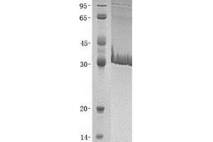 Validation with Western Blot (CA8 Protein)