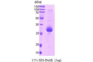 SDS-PAGE (SDS) image for Baculoviral IAP Repeat-Containing 5 (BIRC5) (AA 1-142) protein (Calmodulin (CaM)) (ABIN667066)