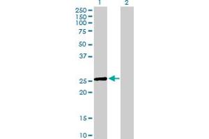 Western Blot analysis of EGLN3 expression in transfected 293T cell line by EGLN3 MaxPab polyclonal antibody.