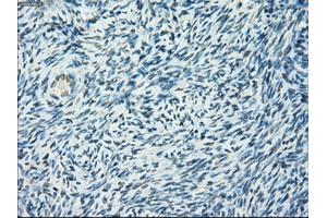 Immunohistochemical staining of paraffin-embedded colon tissue using anti-PORmouse monoclonal antibody. (POR antibody)