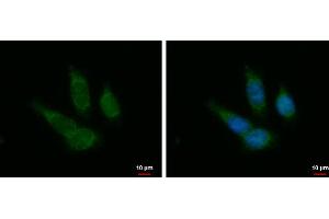 ICC/IF Image PTOV1 antibody detects PTOV1 protein at cytoplasm by immunofluorescent analysis.