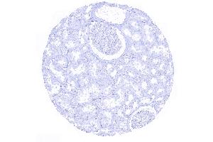 Immunohistochemistry (IHC) image for anti-Mucin 1 (MUC1) antibody (ABIN7477525)