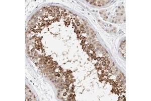 Immunohistochemical staining (Formalin-fixed paraffin-embedded sections) of human testis with CRAT polyclonal antibody  shows strong cytoplasmic positivity in cells in seminiferous ducts.