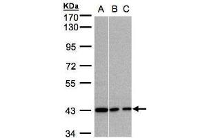WB Image Sample (30μg whole cell lysate) A:A431, B:MOLT4 , C:Raji , 7. (G Protein alpha Inhibitor 3 (Center) antibody)