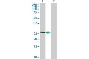 Western Blot analysis of PTTG2 expression in transfected 293T cell line ( H00010744-T01 ) by PTTG2 MaxPab polyclonal antibody. (PTTG2 antibody  (AA 1-191))