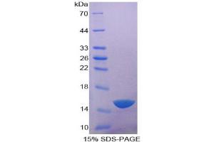 SDS-PAGE analysis of Human Acid Phosphatase 1 Protein. (ACP1 Protein)