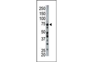 Image no. 1 for anti-Acyl-CoA Synthetase Long-Chain Family Member 6 (ACSL6) (Middle Region) antibody (ABIN357782) (ACSL6 antibody  (Middle Region))
