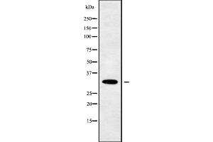 Western blot analysis OR10W1 using 293 whole cell lysates (OR10W1 antibody  (Internal Region))
