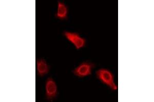 ABIN6275649 staining Hela by IF/ICC. (Ubiquilin 3 antibody  (Internal Region))
