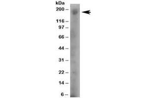 Western blot testing of human A431 lysate with DOCK1 antibody at 4ug/ml. (DOCK1 antibody)