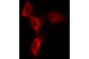 ABIN6274621 staining 293T by IF/ICC. (COL1A2 antibody  (N-Term))