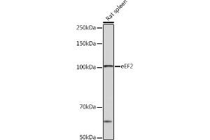 Western blot analysis of extracts of Rat spleen, using eEF2 Rabbit mAb (ABIN7267025) at 1:1000 dilution. (EEF2 antibody)