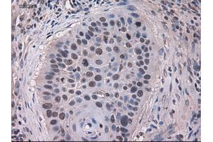 Immunohistochemical staining of paraffin-embedded kidney using anti-KRT18 (ABIN2452674) mouse monoclonal antibody. (Cytokeratin 18 antibody  (AA 69-372))