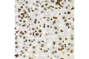 Immunohistochemistry (Paraffin-embedded Sections) (IHC (p)) image for anti-Nuclear Factor of kappa Light Polypeptide Gene Enhancer in B-Cells 2 (NFKB2) (AA 690-899) antibody (ABIN3017388)