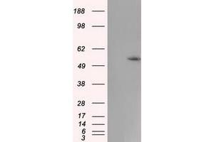 HEK293T cells were transfected with the pCMV6-ENTRY control (Left lane) or pCMV6-ENTRY CYP1A2 (Right lane) cDNA for 48 hrs and lysed. (CYP1A2 antibody)