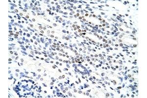 NOL4 antibody was used for immunohistochemistry at a concentration of 4-8 ug/ml to stain Epithelial cells of renal tubule (arrows) in Human Kidney. (NOL4 antibody  (N-Term))