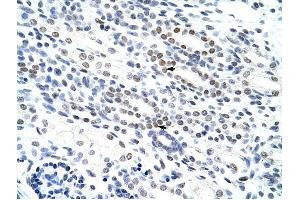 NOL4 antibody was used for immunohistochemistry at a concentration of 4-8 ug/ml to stain Epithelial cells of renal tubule (arrows) in Human Kidney.