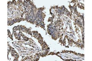IHC analysis of MAT2A using anti-MAT2A antibody (ABIN7599120). (MAT2A antibody  (AA 1-229))
