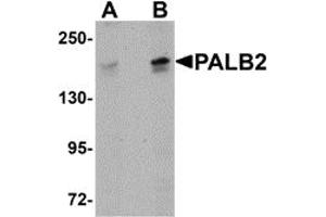 Western Blotting (WB) image for anti-Partner and Localizer of BRCA2 (PALB2) (C-Term) antibody (ABIN1030568)