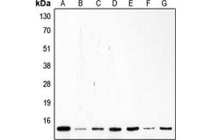 Western blot analysis of p14 ARF expression in Saos2 (A), Molt (B), K562 (C), Jurkat (D), HL60 (E), MCF7 (F), HeLa (G) whole cell lysates. (CDKN2A antibody  (Center))