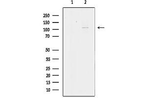Western blot analysis of lysates from HeLa cells, using KCNH3 Antibody.