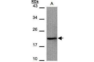 WB Image Sample(30 μg of whole cell lysate) A:293T 15% SDS PAGE antibody diluted at 1:1000 (Survivin antibody)